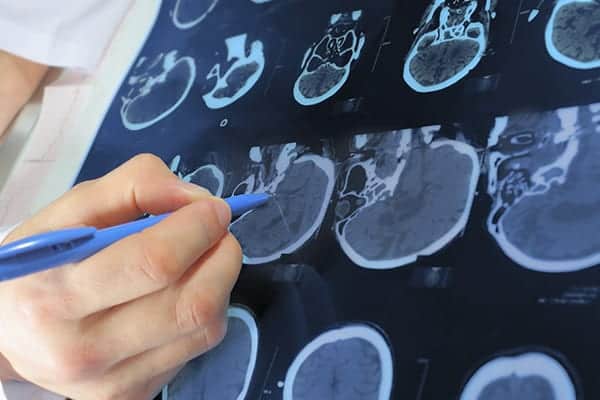 imagerie neurologique scanner orl centre radiologie imagerie irm medicale ouest parisien cimop paris 16 rueil malmaison sevres saint cloud