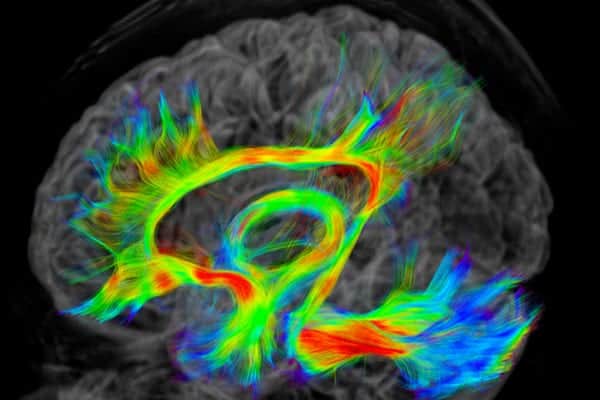 imagerie neuro orl centre radiologie imagerie irm medicale ouest parisien cimop paris 16