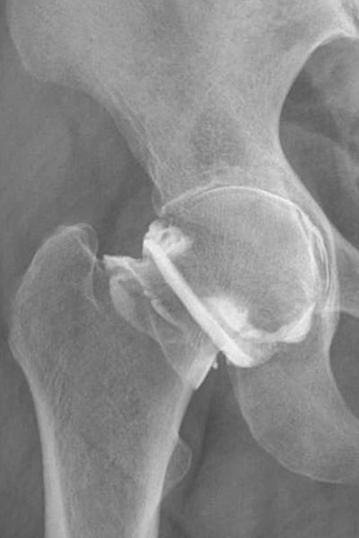 infiltration osteo articulaire arthroscanner centre radiologie imagerie irm medicale ouest parisien cimop paris 16