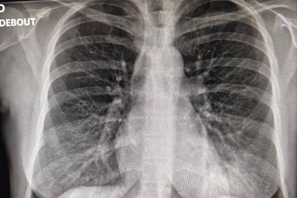 radio thorax femme centre radiologie imagerie irm medicale ouest parisien cimop paris 16