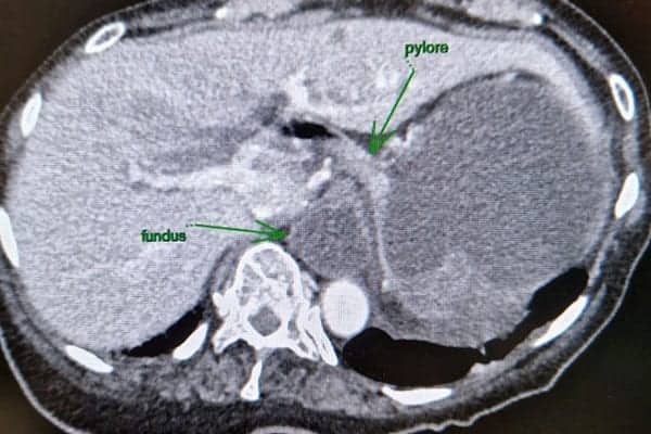 scanner abdominal centre radiologie imagerie irm medicale ouest parisien cimop paris 16