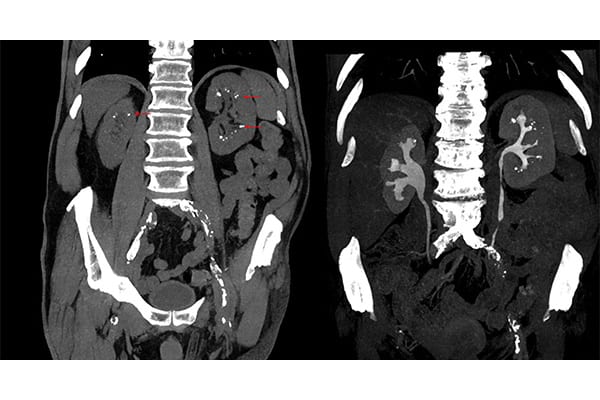 uroscanner avec sans injection centre radiologie imagerie irm medicale ouest parisien cimop paris 16