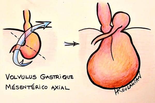 volvulus gastrique symptomes centre radiologie imagerie irm medicale ouest parisien cimop paris 16