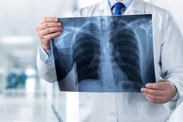 radiographie poumon centre radiologie imagerie irm medicale ouest parisien cimop paris 16