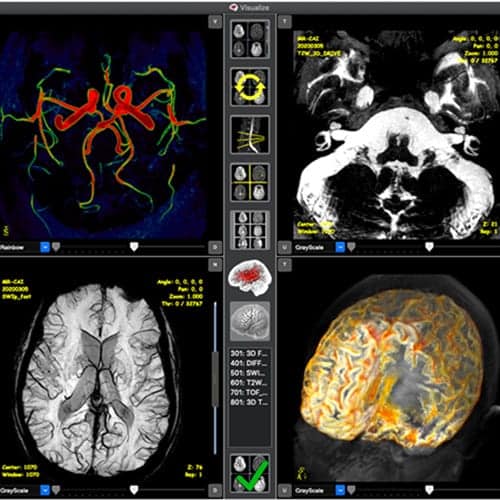 resultat irm cerebrale rdv centre radiologie imagerie irm medicale ouest parisien cimop paris 16